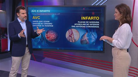 Pessoas Que Tiveram Avc T M Mais Risco De Infarto Revela Estudo Da Usp