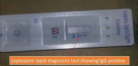 Leptospira Rapid Diagnostic Test Positive Introduction Principle