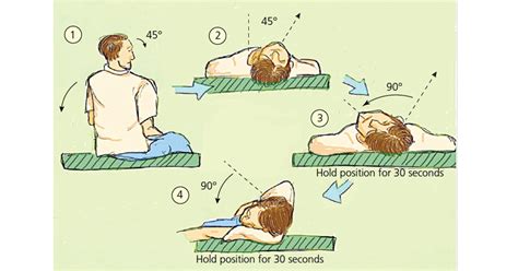 Epley Maneuver As The World Turns Mayo Clinic Health System However A Modified Epley