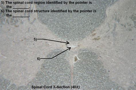 Quiz Nervous System Histology Atlas For Anatomy And Physiology