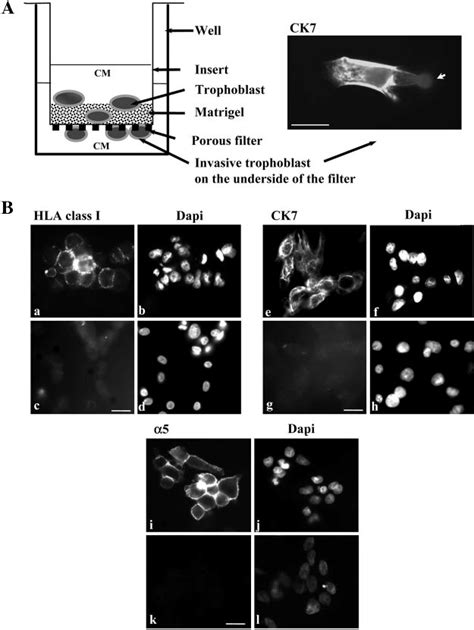 In Vitro Model Of Trophoblast Invasion A In Vitro Model Used To Study