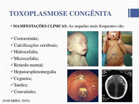 Toxoplasmose E Rúbeola