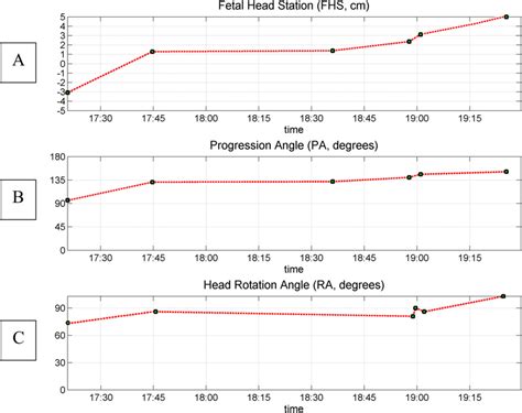 Eco View Panel Of Final Charts Leading Vaginal Delivery Download