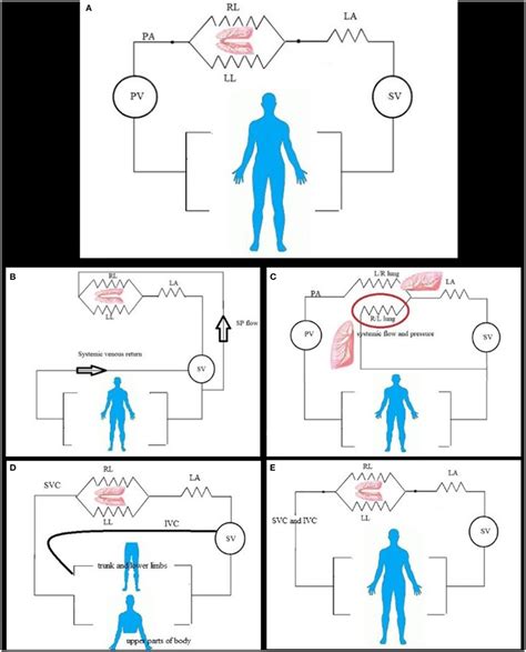 (A) In normal and simple shunt condition, the pulmonary flow is ...