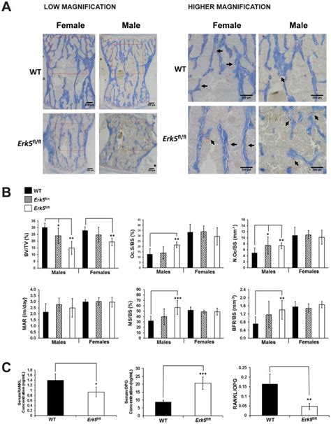 Analysis Of Nkx3 1 Cre Driven Erk5 Deletion Reveals A Profound Spinal Deformity Which Is Linked