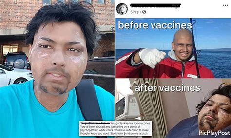 Anti Vaxxers Troll A Sydney Cancer Victim With A Fake Meme And Accuse