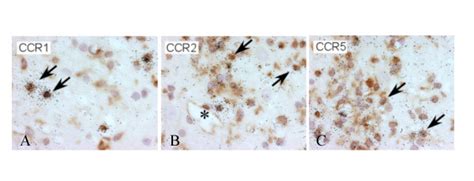 Temporal Expression And Cellular Origin Of Cc Chemokine Receptors Ccr1