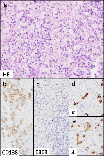 Histology Of The Surgical Specimen Hematoxylin And Eosin Staining