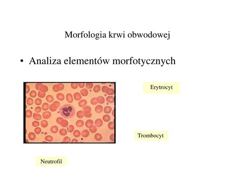 Ppt Morfologia Krwi Obwodowej U Dzieci I Doros Ych Powerpoint