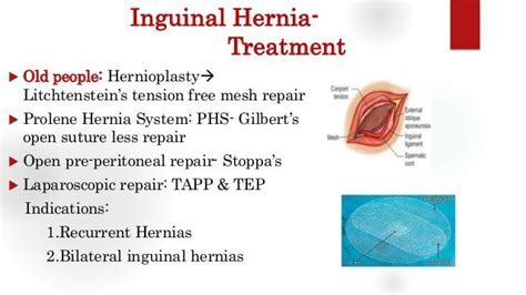 Inguinal Hernia Groin Swellings