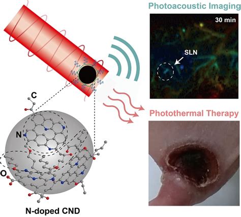 Biodegradable Nitrogen Doped Carbon Nanodots For Non Invasive