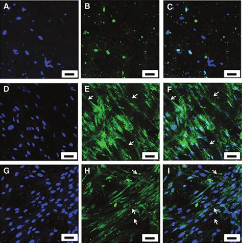 Immunohistochemical Staining Of Collagen Types I And III Within The