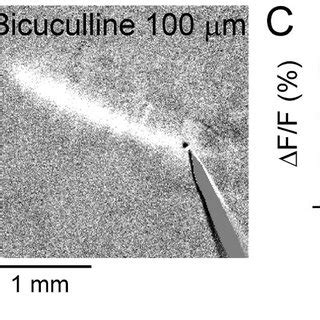 Setup And Example Result Of Flavoprotein Autofluorescence Imaging