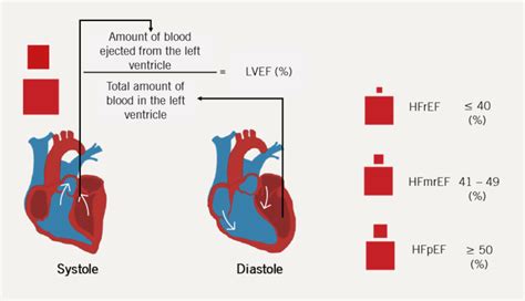 Heart Failure Learning Module 1 Background Epidemiology Aetiology