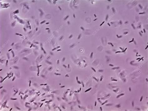 Bacteria from chicken - Stock Video Clip - K003/2805 - Science Photo ...