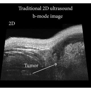 A 2D And B 3D B Mode Ultrasound Images From The Same Sample