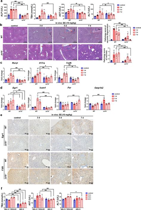 Inkt Cell Deficiency Or The Removal Of Inkt Cells Mitigated Ee Induced