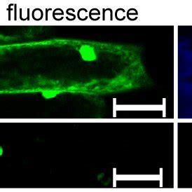 Subcellular Localization Of Tanac Protein Egfp Vector Control And