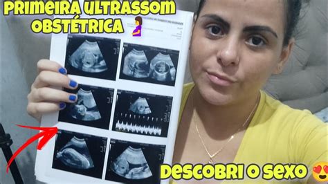 PRIMEIRO ULTRASSOM OBSTÉTRICA 17 semanas e 2 dias YouTube