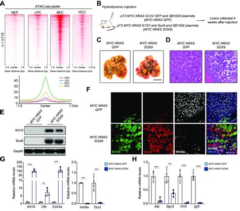 Sox9 Promoted BEC Fate In Less Differentiated HCC A Heatmaps And