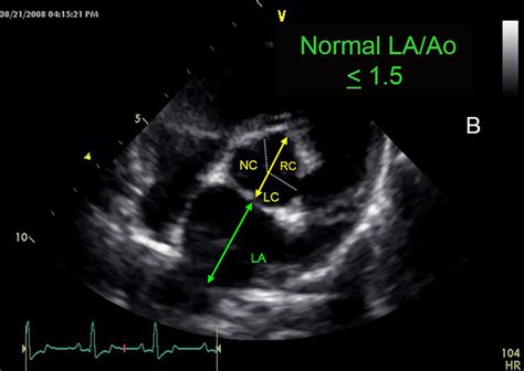 Echocardiography In General Practice Views To Master Clinician S Brief