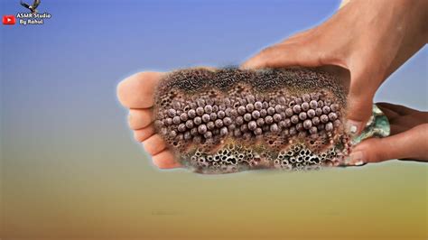 ASMR Remove Trypophobia Maggot Worm Infected Foot Deep Cleaning