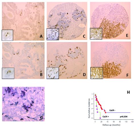 Immunostaining For Calcium Sensing Receptor Casr A C E And