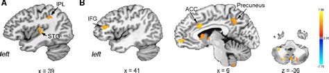 Figure 8 From Behavioral Systems Cognitive Functional But Not