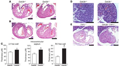 Analysis Of Ventricular Development Hande Stained Sections Of Gsk3b