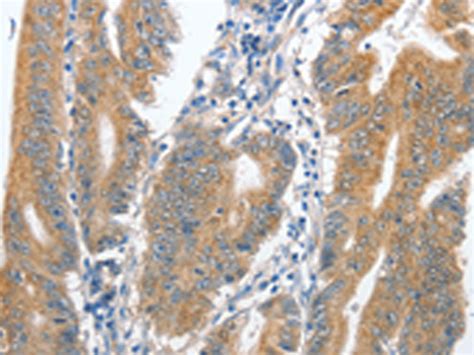 Cenpc Anti Cenpc Rabbit Polyclonal Antibody