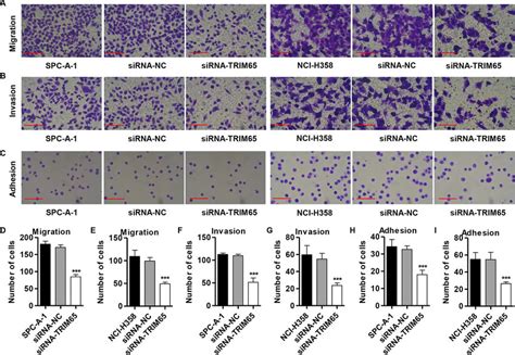 Knockdown Of Trim Inhibits Migration Invasion And Adhesion In Human