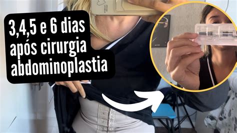 Dias Ap S Cirurgia Abdominoplastia N O Est Sendo F Cil Passar