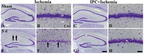 Ischemic Preconditioning Protects Neurons From Damage And Maintains The