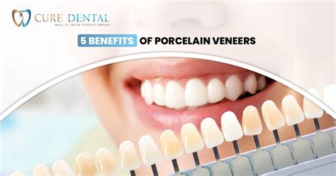 5 Benefits Of Porcelain Veneers Cure Dental