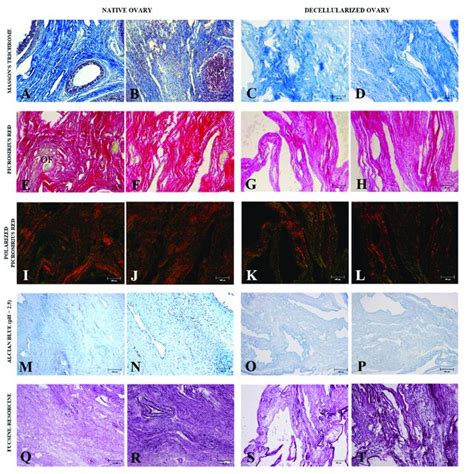 Morphological Analysis Of Ovarian Ecm From Native And Decellularized