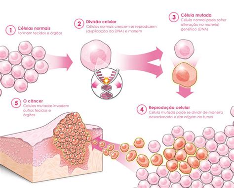 Neoplasia Conceito