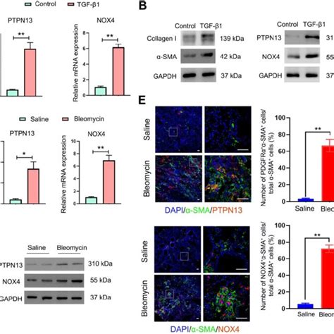 Distribution And Localization Of Pdgfrα In Fibrotic Lung Tissue And