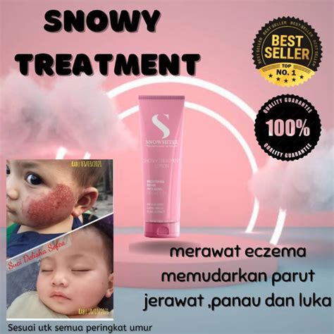 Snowhitee Original Snowy Treatment Lotion Susu Unta Eczema Krim Kulit