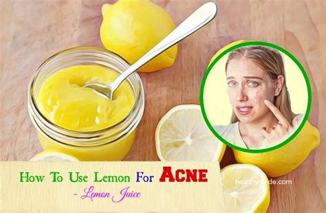 Tips How To Use Lemon For Acne And Pimples Scars Spots Removal