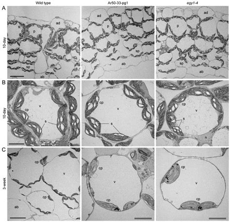 Ultrastructural Analysis Of Leaf Tissues And Cells In Wild Type And