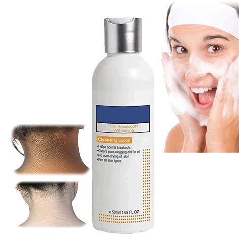 50ml Skinenjoy Cleansing Lotion For Acne And Spots And Acanthosis Nigricans