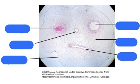 Embryonic Connective Tissue Diagram Diagram Quizlet