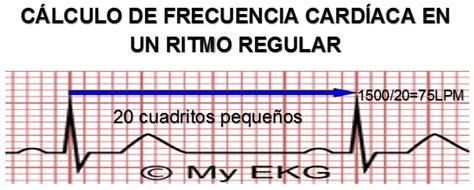 ElectrocardiografÍa BÁsica Para EnfermerÍa Frecuencia CardÍaca En Un Electrocardiograma