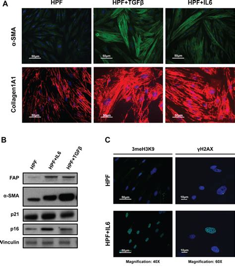 Integrated Gene And Mirna Expression Analysis Of Prostate Cancer Associated Fibroblasts Supports