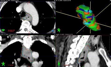 Frontiers Inter Observer And Intra Observer Variability In Gross