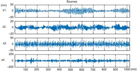 Four Real Vibration Signals Download Scientific Diagram