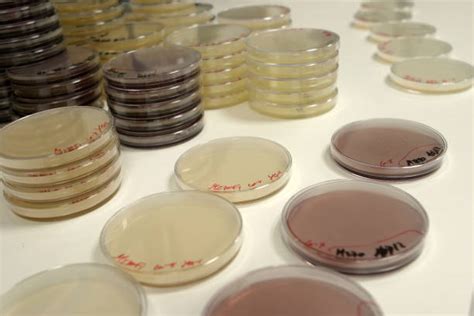 Best Fecal Coliform Bacteria Stock Photos, Pictures & Royalty-Free Images - iStock