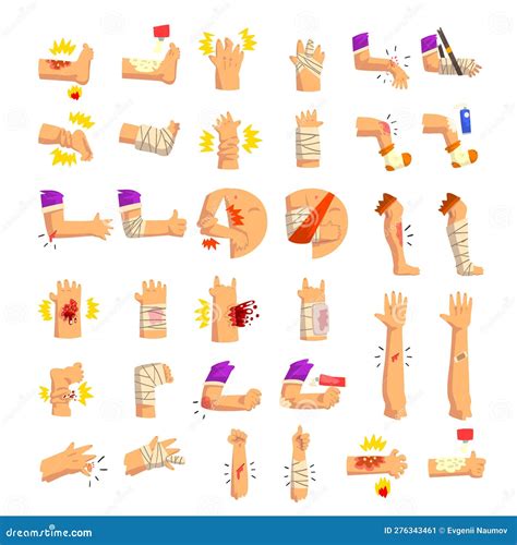 Bandaged Injured Human Body Parts Set Cartoon Vector Illustration Stock ...