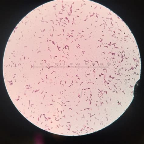 dlane247: Gram stain of the Bacillus subtilis...