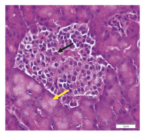 Histopathology Of The Pancreas In A The Normal Control Group B The